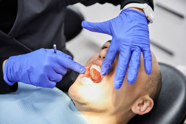Best Knocked-Out Tooth (Avulsed Tooth) Treatment in Ocean View, DE